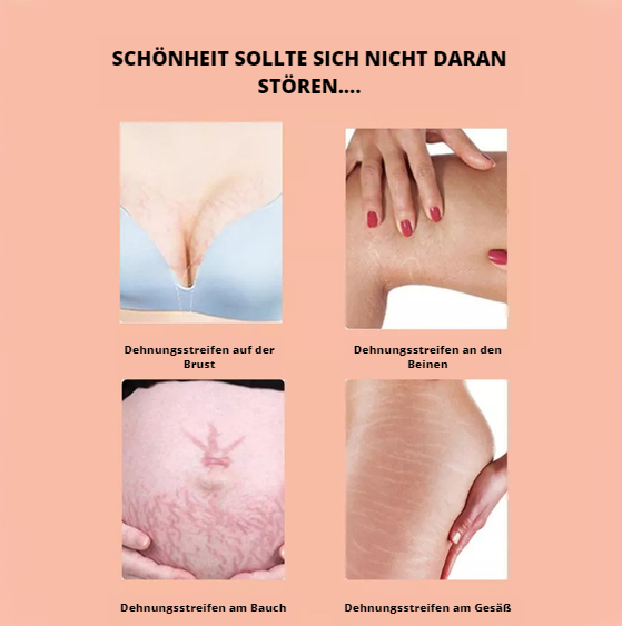 Passions | Sofort-Dehnungsstreifen-Öl | 1 + 1 GRATIS (letzter Tag)