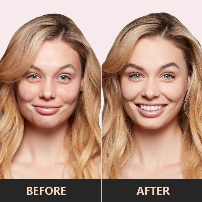 Flysmus™ 3-In-1 Concealer-Palette | 50% Rabatt!