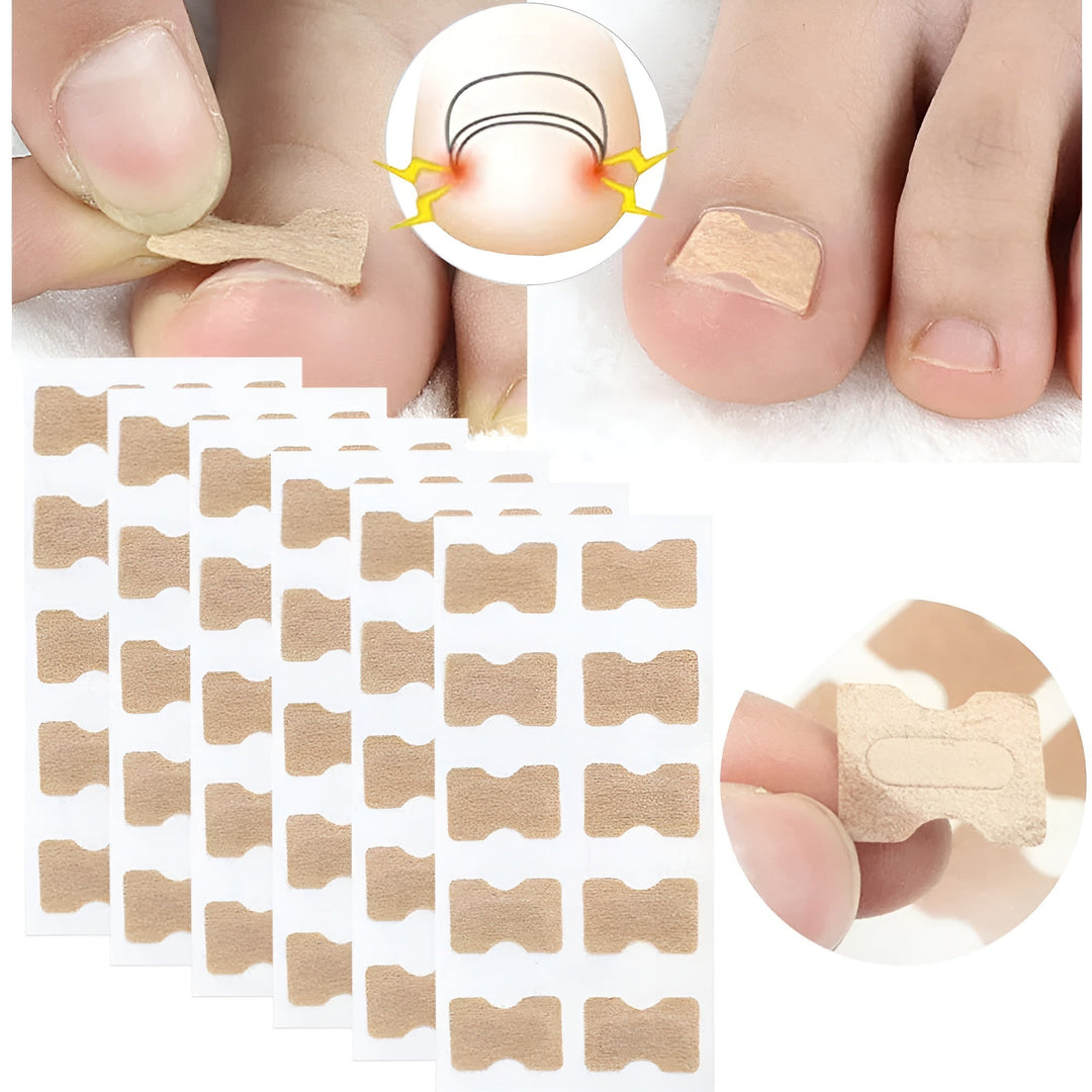 NagelVital Pro - Pflegeaufkleber für Nagelkorrekturen | 50% RABATT