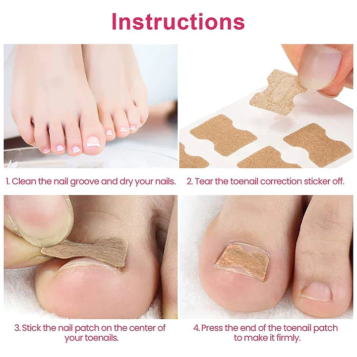 NagelVital Pro - Pflegeaufkleber für Nagelkorrekturen | 50% RABATT